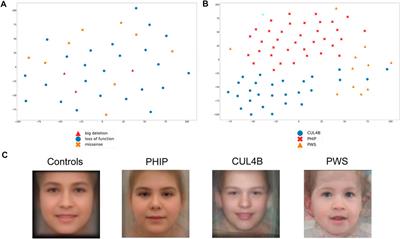 PHIP-associated Chung-Jansen syndrome: Report of 23 new individuals
